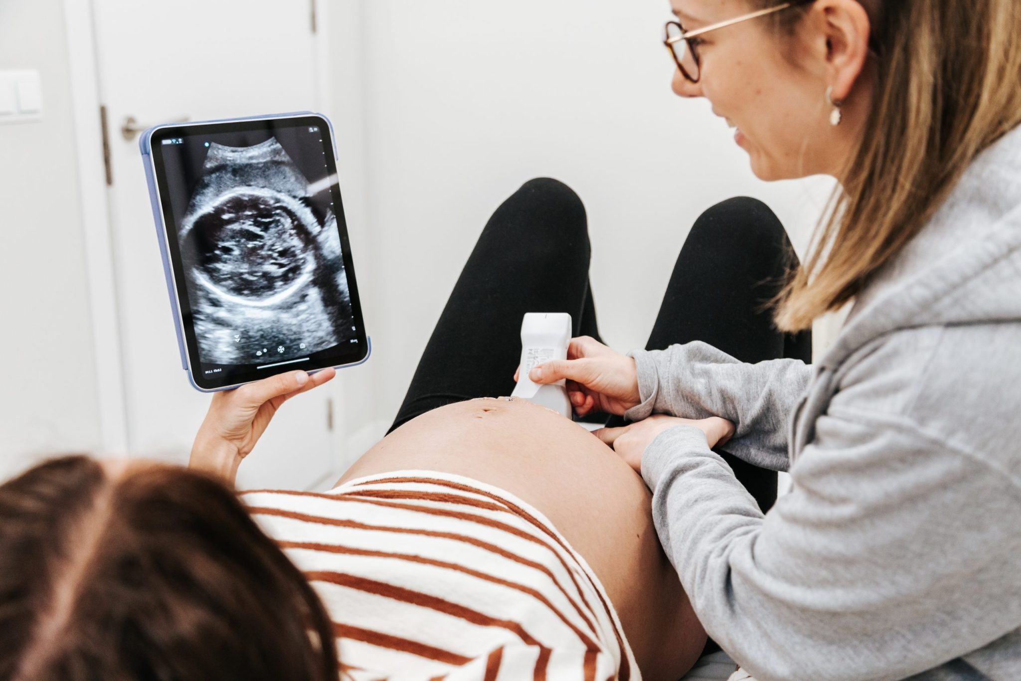 preparacion parto fisio ecografo